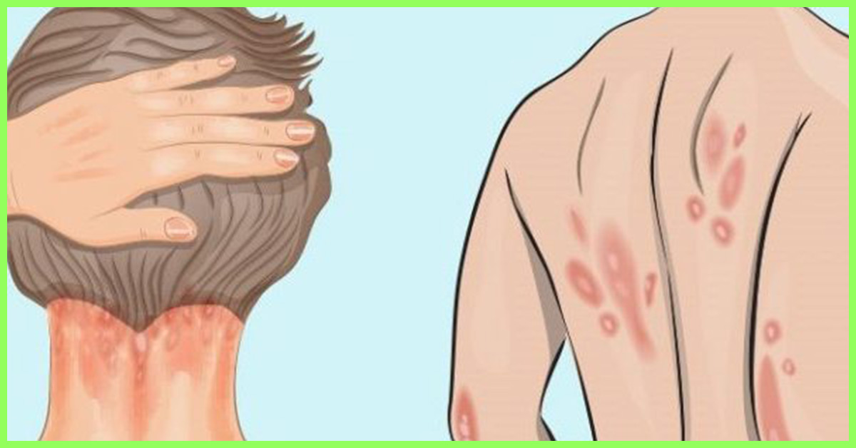 A brief about the symptoms of low Vitamin D?