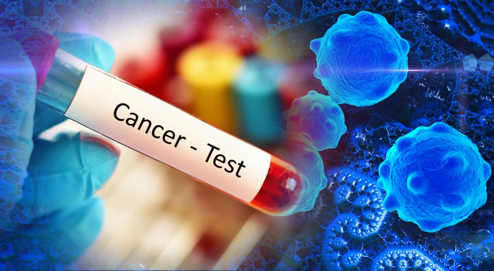 Can blood tests detect cancer? Understanding what’s possible today