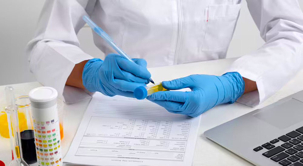 What To Expect During A TB PCR Test 