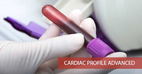 Cardiac Profile Advanced